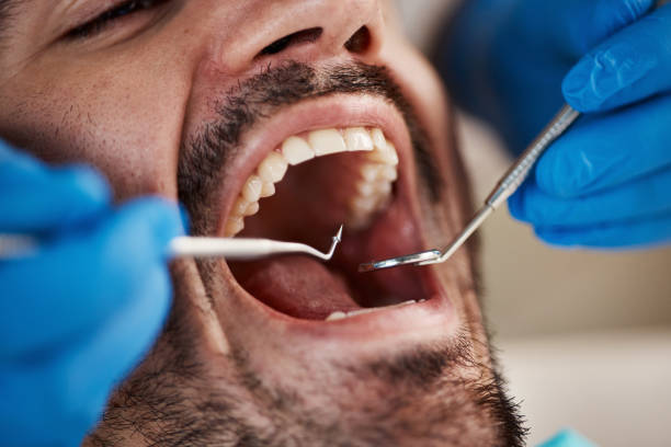 Best Cracked Tooth Emergency Dentist  in Steger, IL