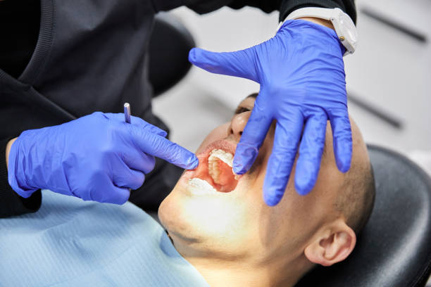 Best Teeth Whitening  in Steger, IL