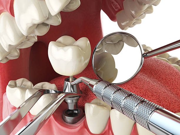 Best Emergency Tooth Extraction  in Steger, IL